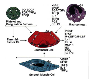 Figure 1 - Genesis of Atherosclerosis