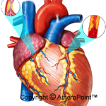 Figure 10 - Cause of Cardiac Arrest