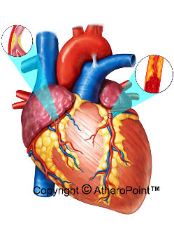 Figure 10 - Cause of Cardiac Arrest 