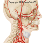 Figure 7 - Location of the Carotid Arteries