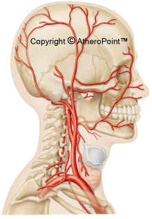 Figure 7 - Location of the Carotid Arteries