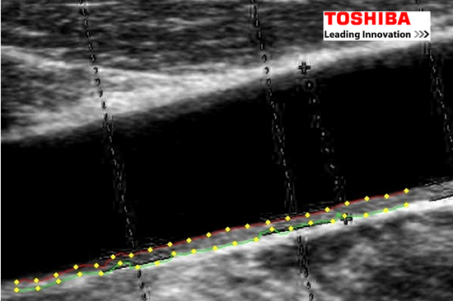 OEMtype_ToshibaImg2