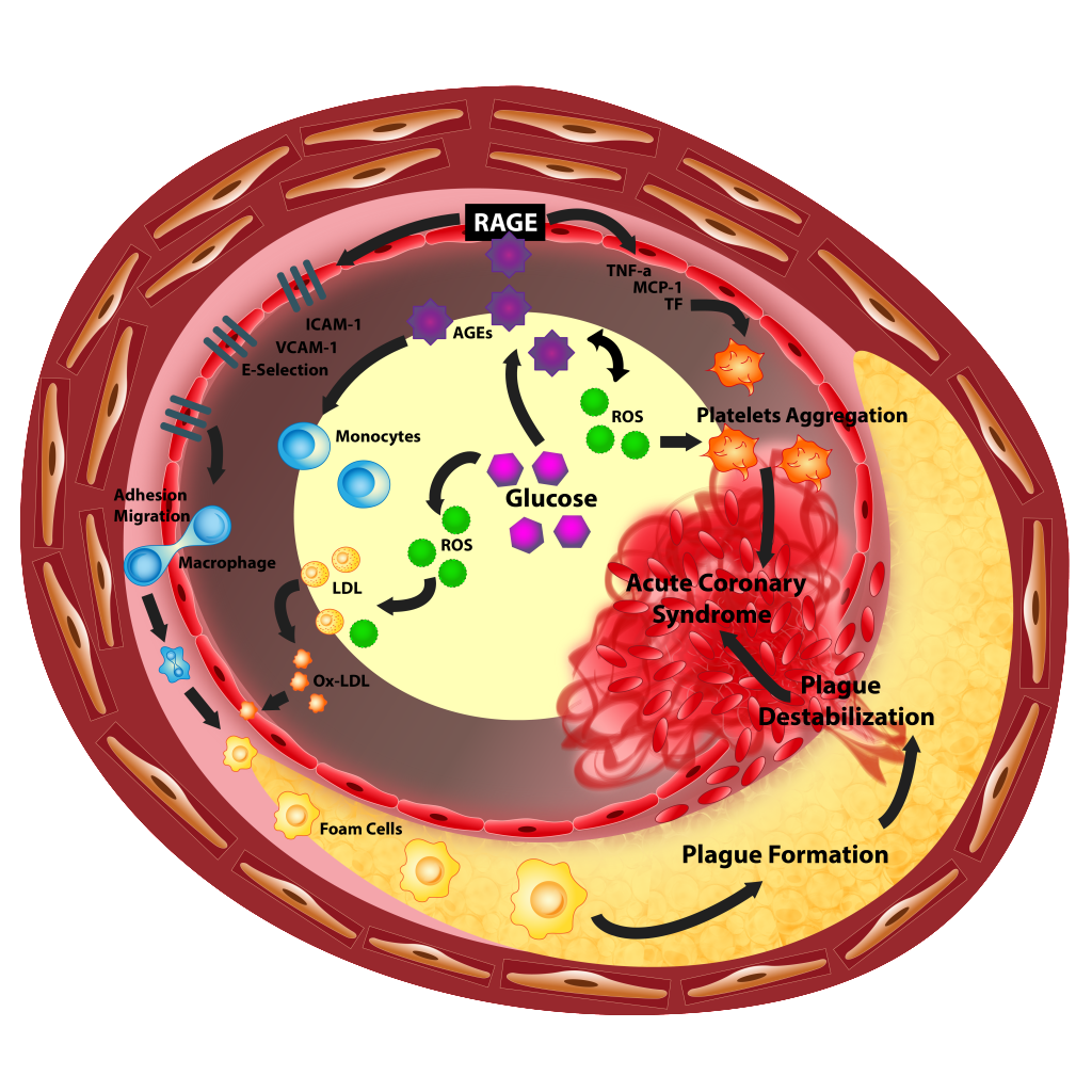 Genesis of Diabetes-01
