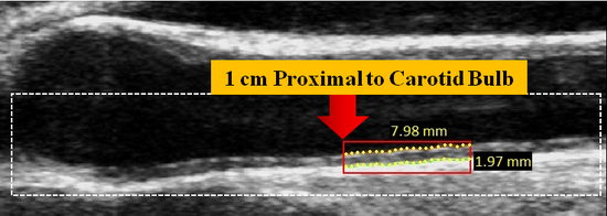 ProximalBifurcationPosition2_v5.0