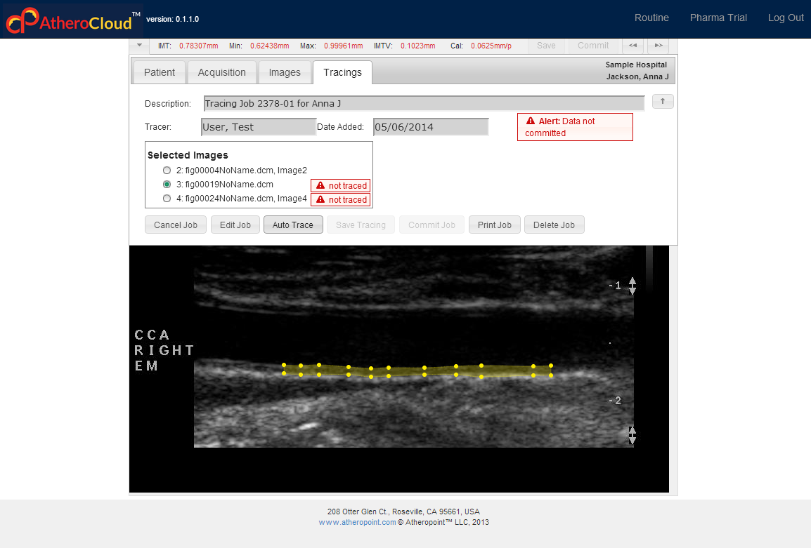 ACAutoTrace