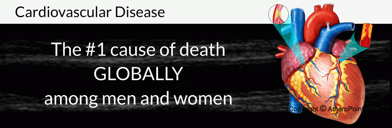 Cardiovascular Disease
